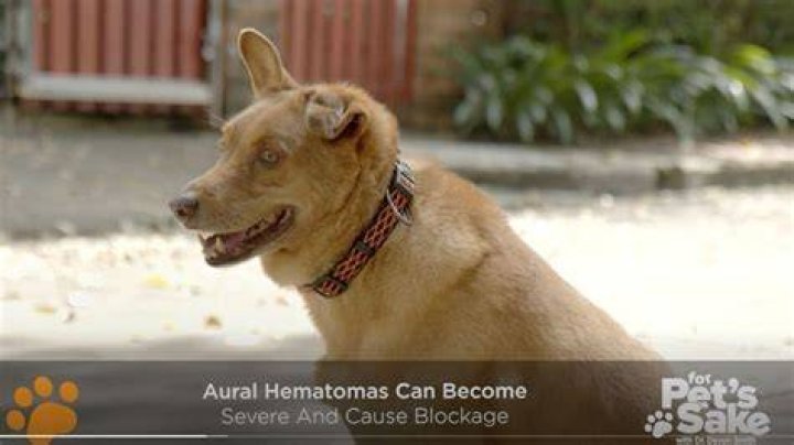 Are hematomas deadly? | ContextResponse.com