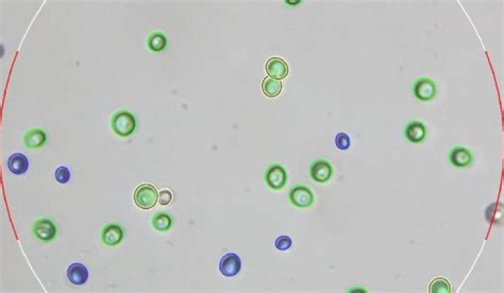 Are yeast cells alive?