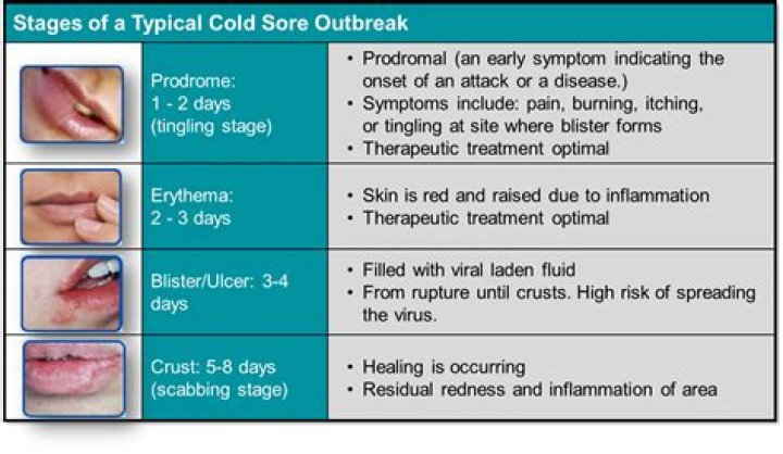 Can a cold sore go away in 3 days?