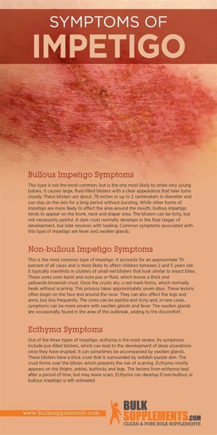 Can adults get impetigo?