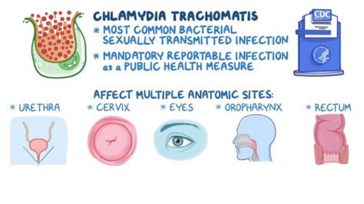 Can Chlamydia trachomatis cause pneumonia?