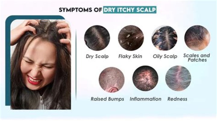 Can coloring your hair cause itchy scalp?