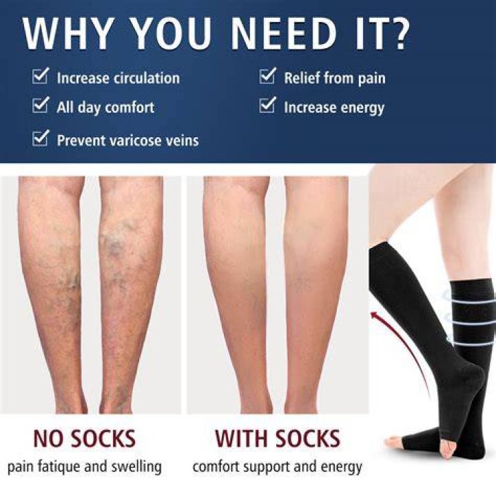 Can compression socks help calf pain?