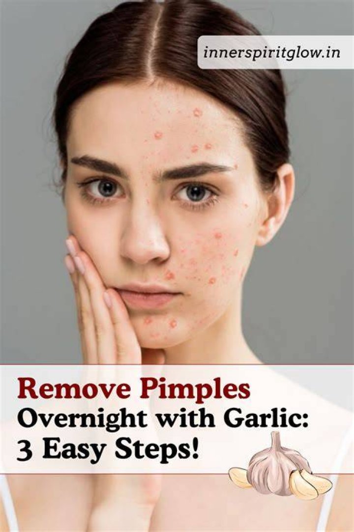 Can garlic remove pimples?