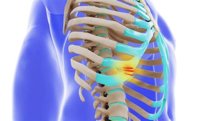 Can GERD cause rib cage pain?
