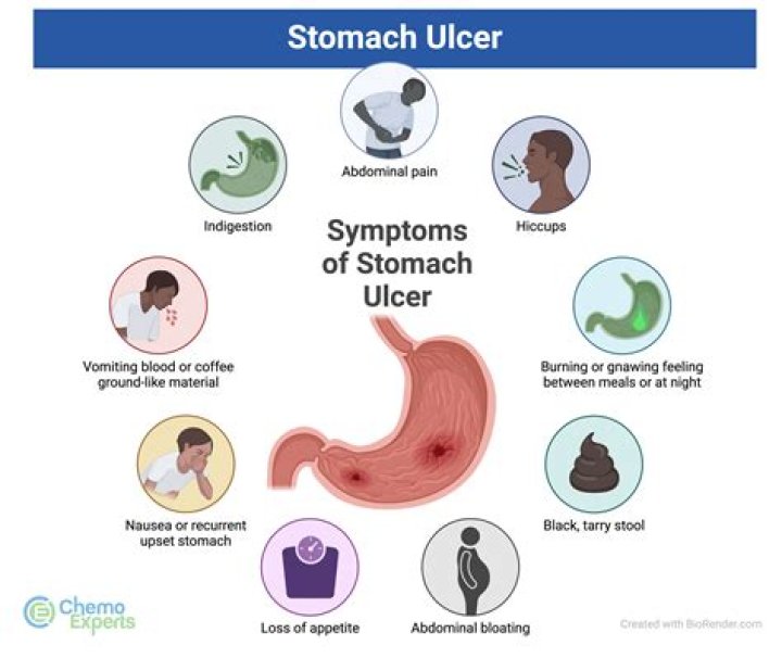 Can hernias cause ulcers?