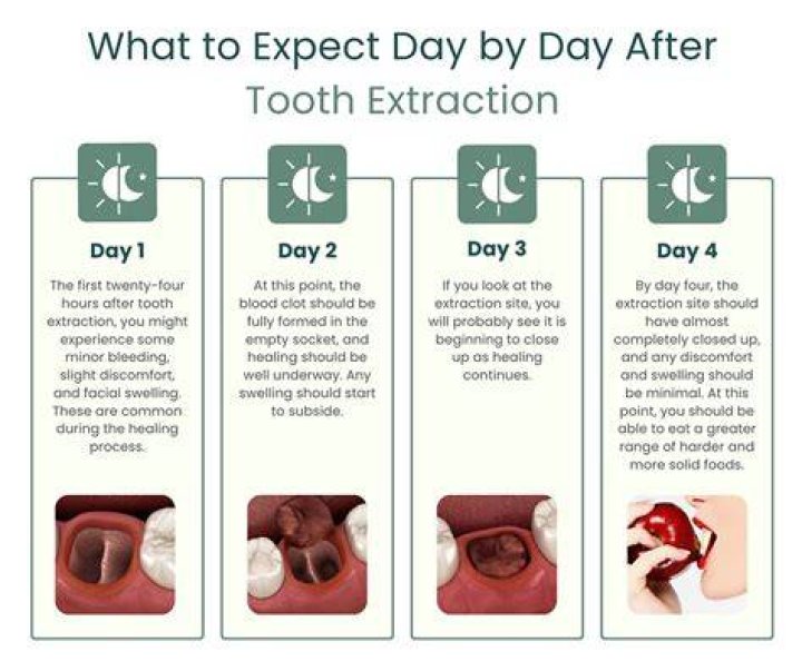 Can I eat rice 5 days after wisdom teeth?