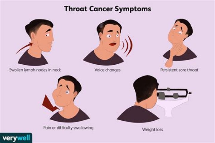 Can smoking give you throat cancer?