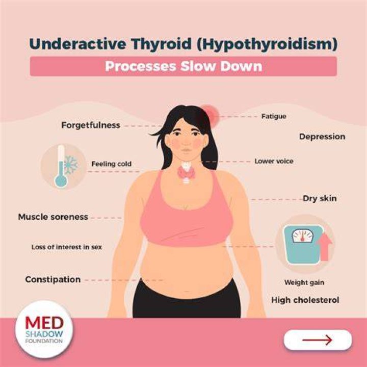 Can Thyroid be contagious?