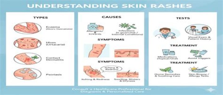 Can weeds cause a rash?
