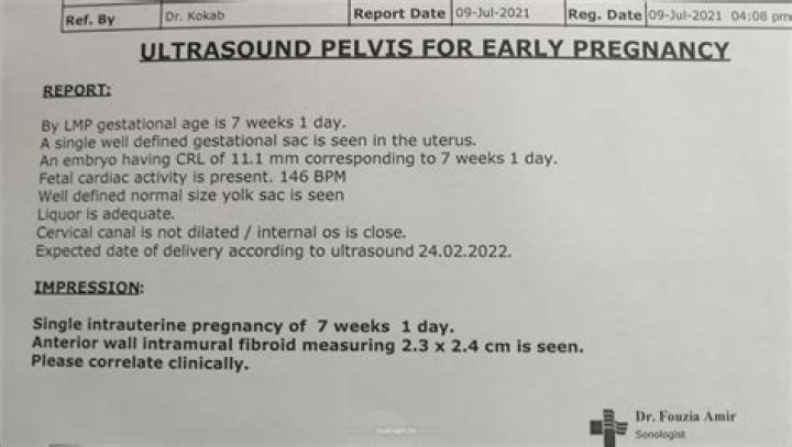 Can you ask for an ultrasound?