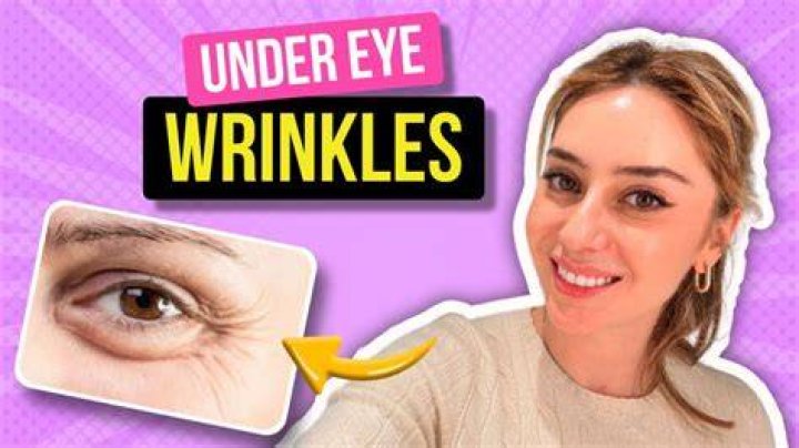 Can you get wrinkles from smiling?
