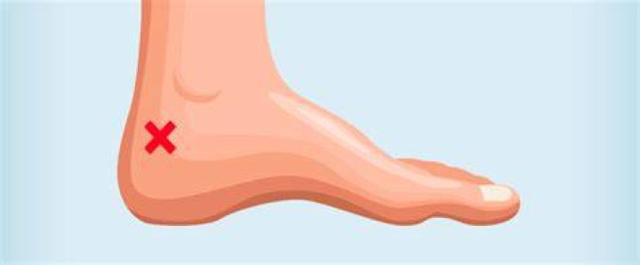 Can you see your pulse in your ankle?