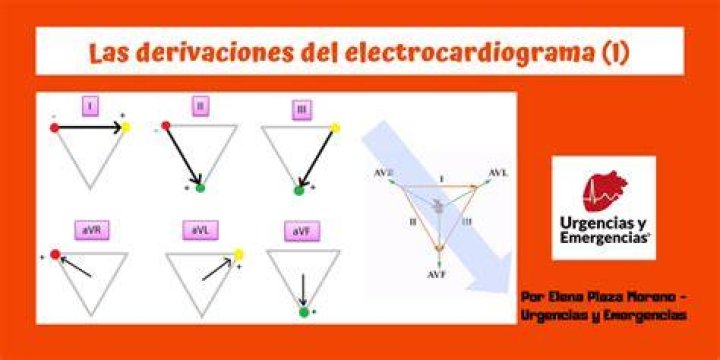 ¿Cuántas derivaciones tiene un electrocardiograma?