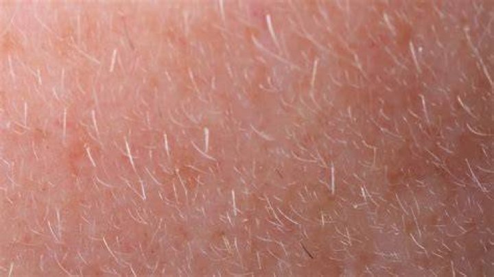 Do humans have mites on their skin?