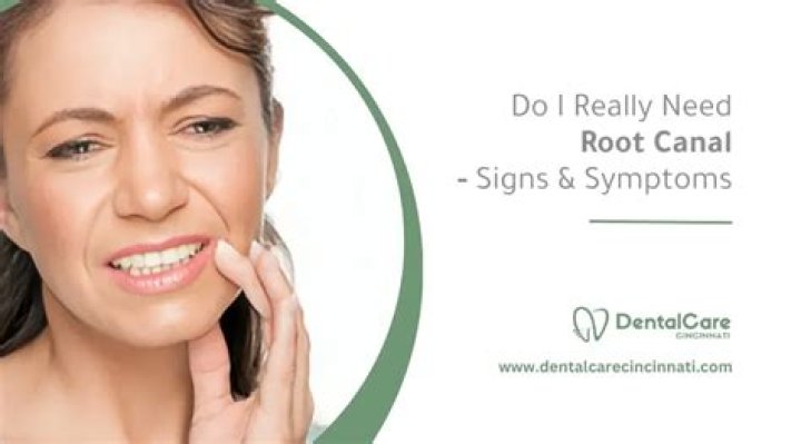 Do I really need a root canal?