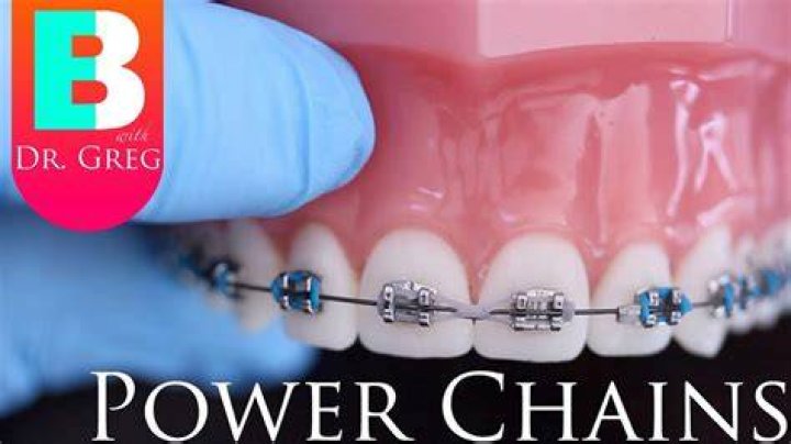 Do power chains close gaps?
