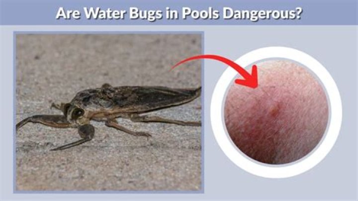 Do water bugs bite pool?