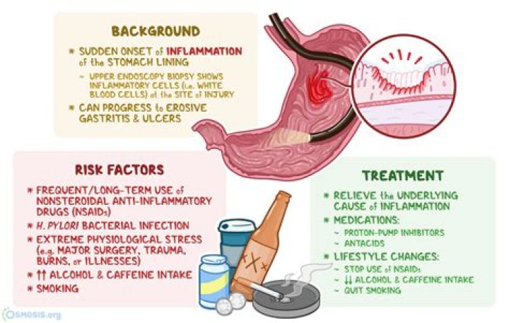 Do you need to see a doctor for gastritis?