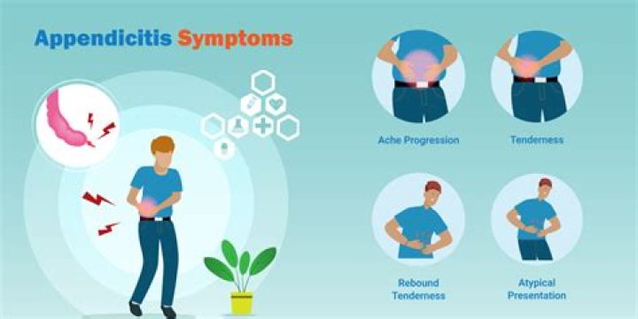 Does Appendicitis hurt to the touch?