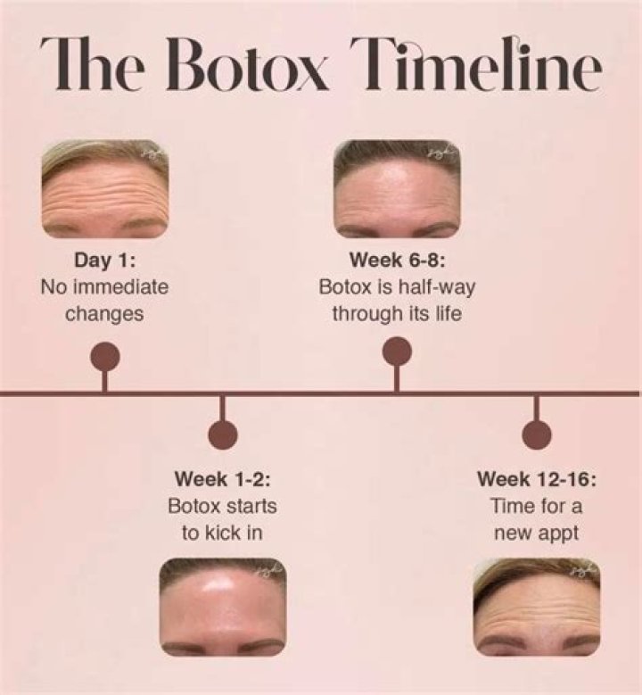 Does Botox make you gain weight?