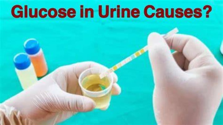 Does glucose in urine always mean diabetes?
