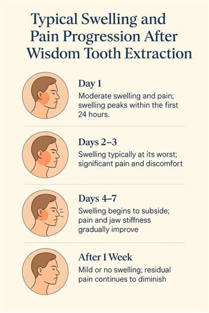 How bad is the pain after wisdom tooth extraction?