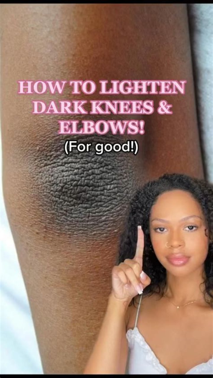 How can I lighten my dark knees?