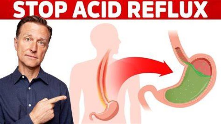 How can I relieve acid reflux?