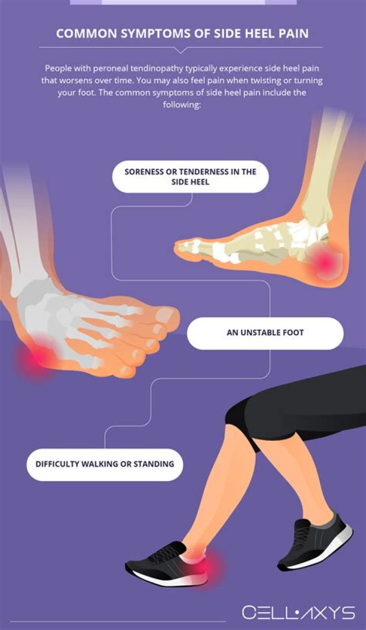 How can I stop heel pain?