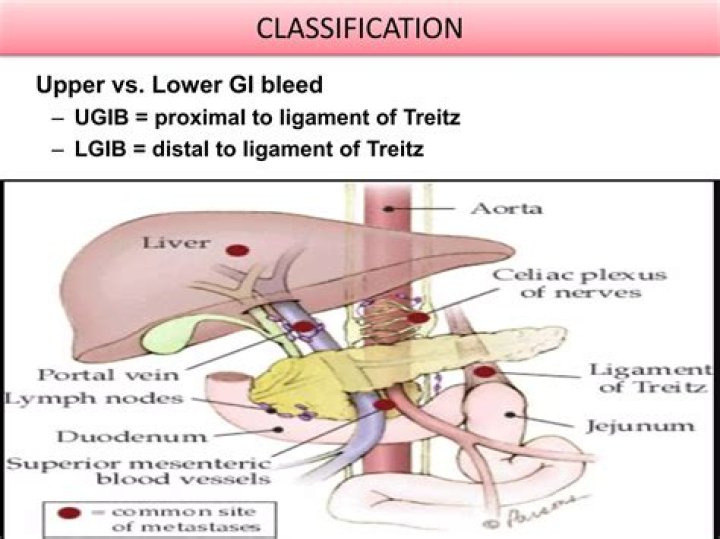 How can you tell the difference between LGIB and UGIB?