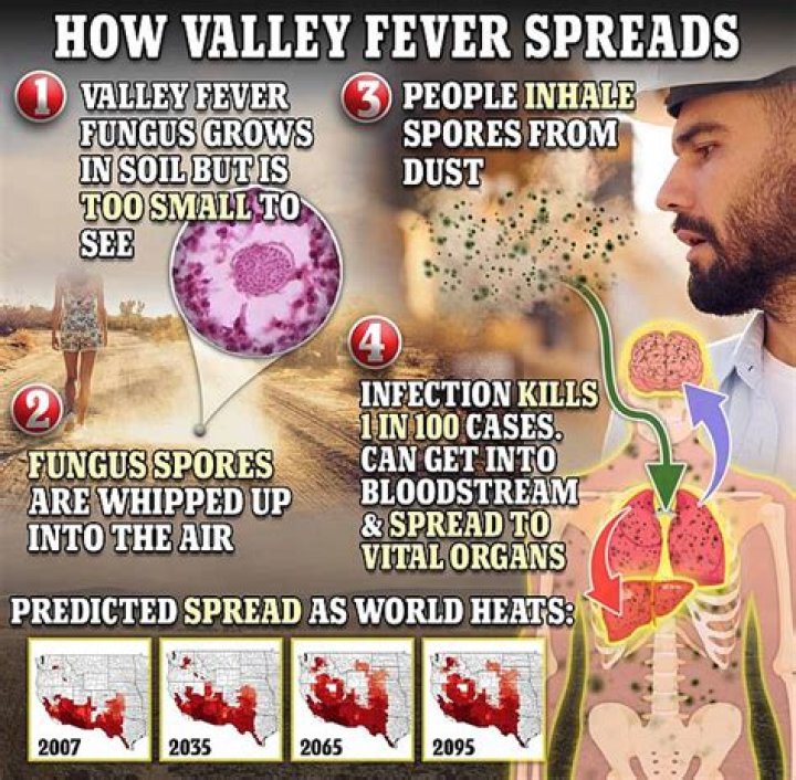How dangerous is valley fever?