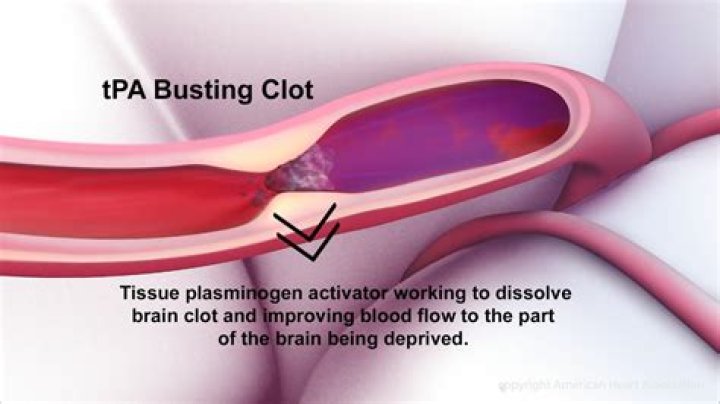 How do clot busting drugs work?