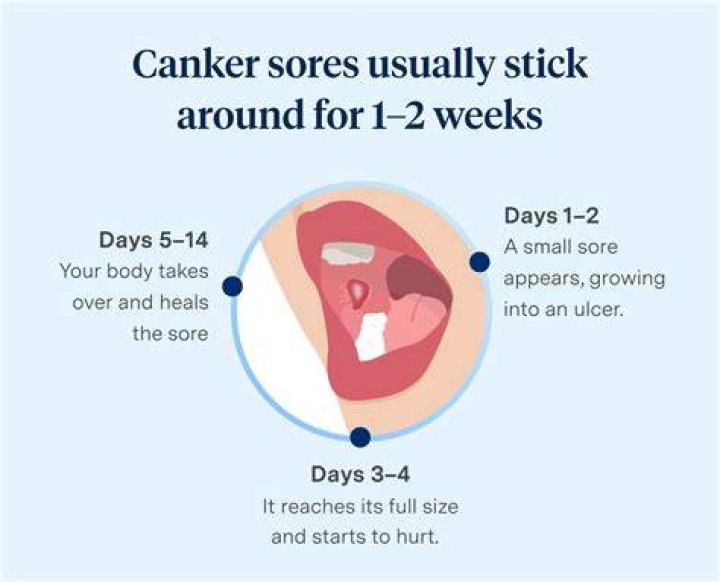 How do I get rid of canker sores fast?