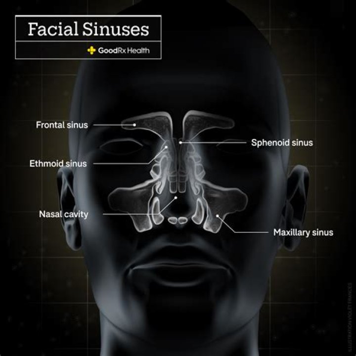 How do I get rid of sinus pressure in my face?