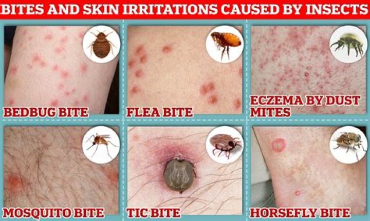 How do I know if I have erythema?