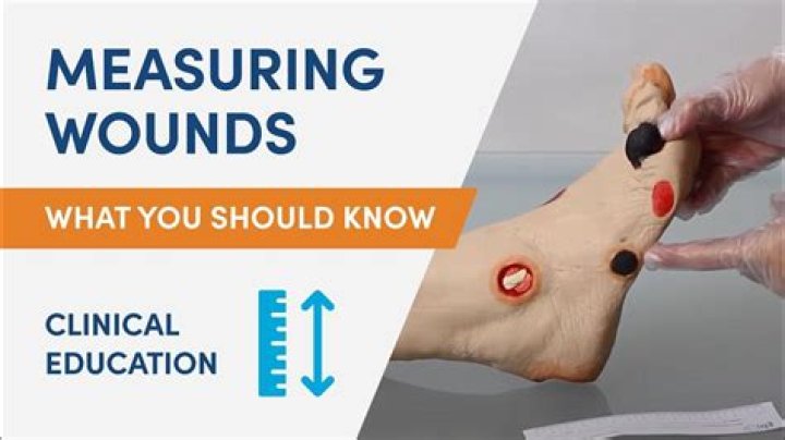 How do you calculate square centimeters of a wound?