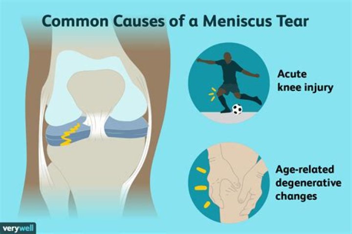 How do you diagnose a lateral meniscus tear?
