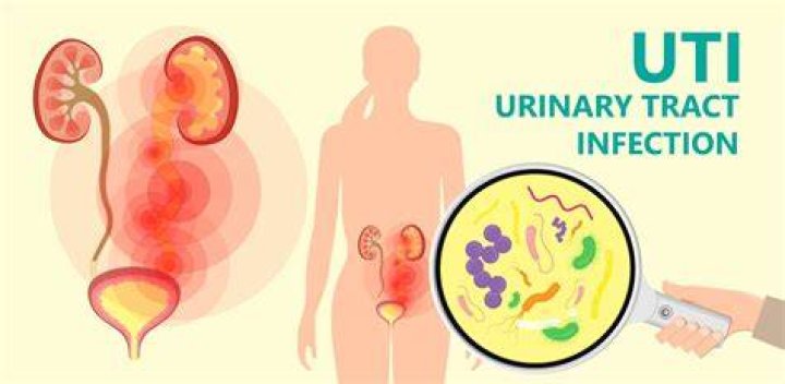 How do you get rid of a urine infection?