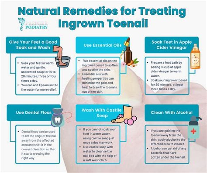 How do you get rid of an ingrown toenail at home?