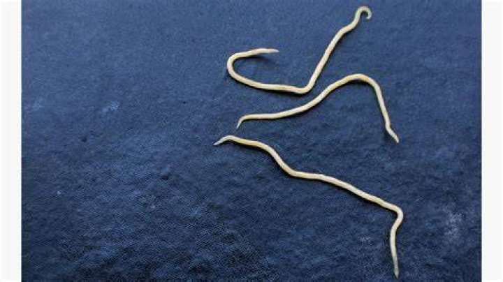 How do you get worms?