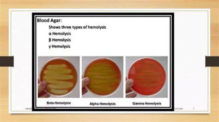 How do you identify beta hemolysis?