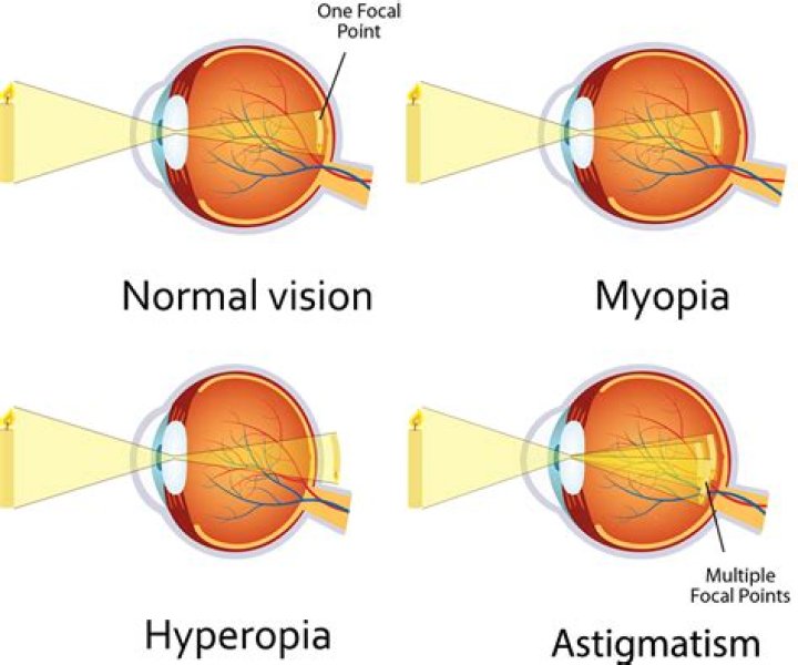 How do you know if you are near or far sighted?