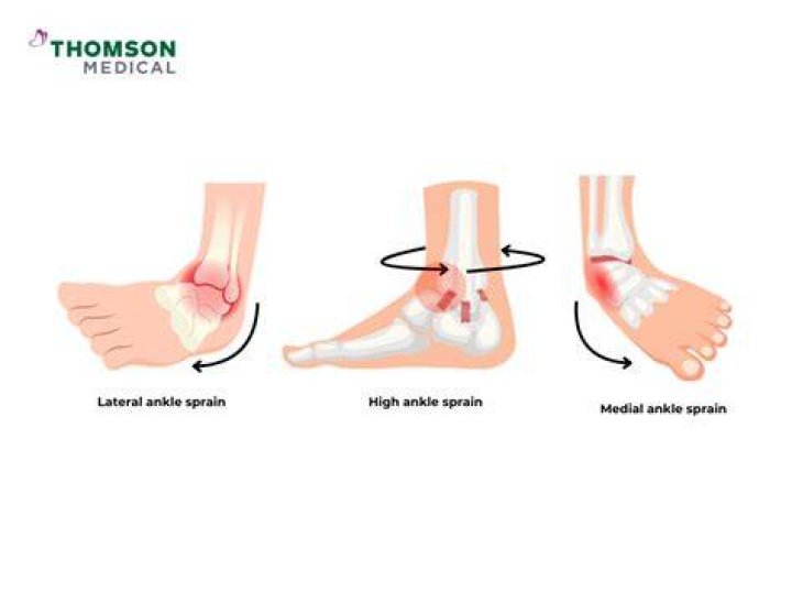 How do you not twist your ankle?