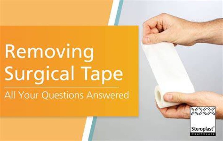How do you remove surgical glue?