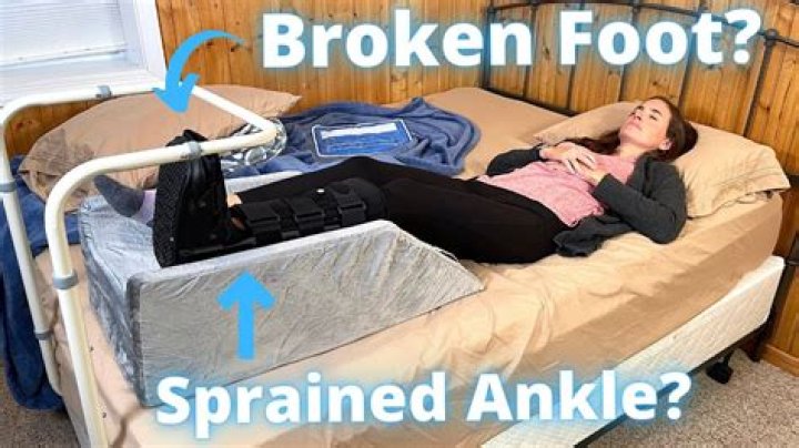 How do you sleep with a broken ankle?