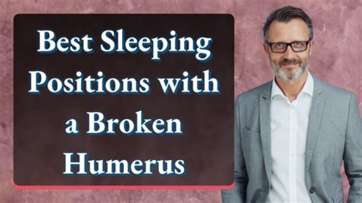 How do you sleep with a broken humerus?