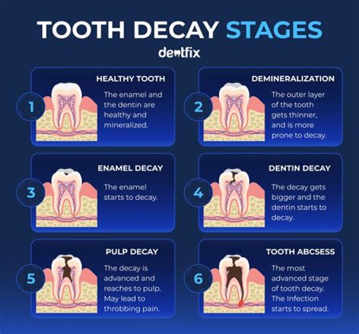 How do you slow down tooth decay?