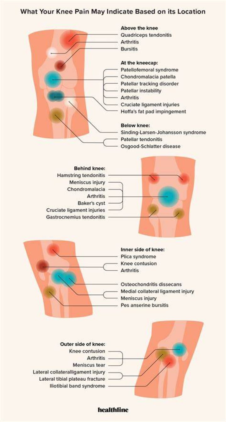 How do you spell excruciating pain?
