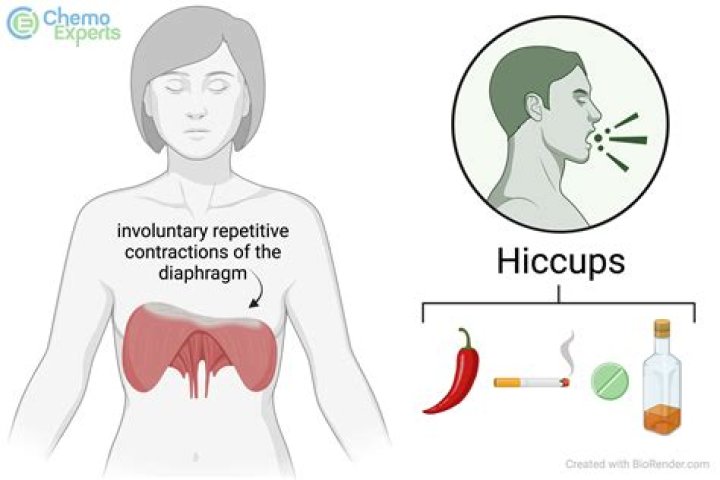 How do you stop hiccups from acid?